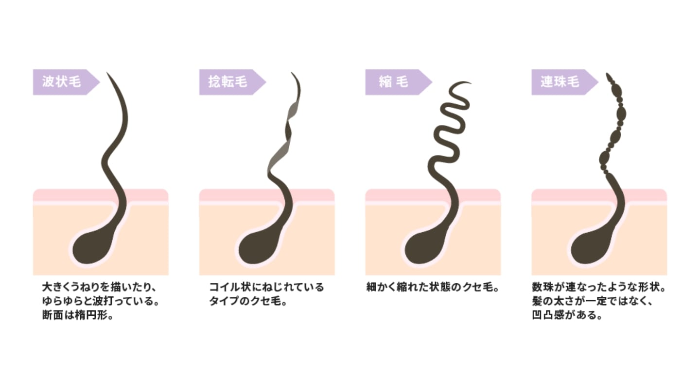 捻転毛はクセ毛の一種！ほかのクセ毛との違いは？