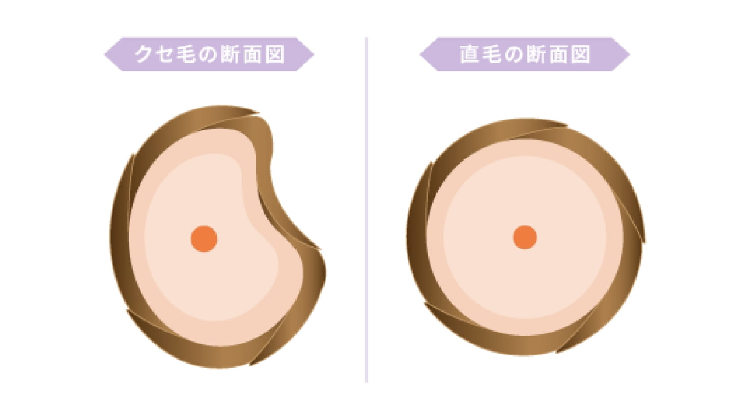 くせ毛の断面図と直毛の断面図