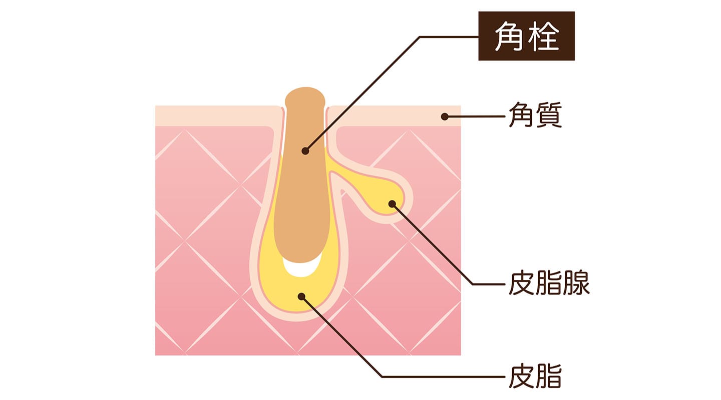 角栓の酸化