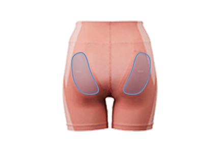 Hip Fitの電極位置画像
