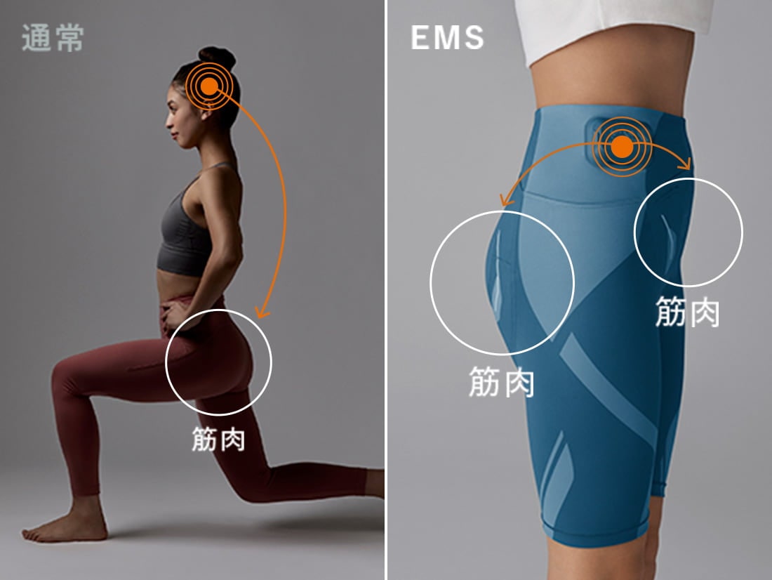 電気刺激によって筋肉をトレーニングするテクノロジー。